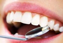 Diş Sağlığı Nedir? Diş Nasıl Beyazlatılır? diş sağlığının önemi