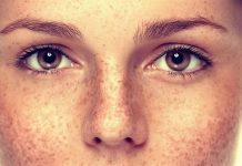 Güneş Lekeleri Nasıl Geçer? güneş lekeleri nasıl çıkar