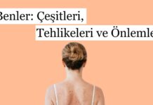 Benler: Çeşitleri, Tehlikeleri ve Önlemler