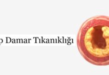 Kalp Damar Tıkanıklığı