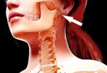 temporomandibular