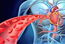 Tıkanmış Damarları Açan Karışım Nasıl Yapılır? damarları açan karışım