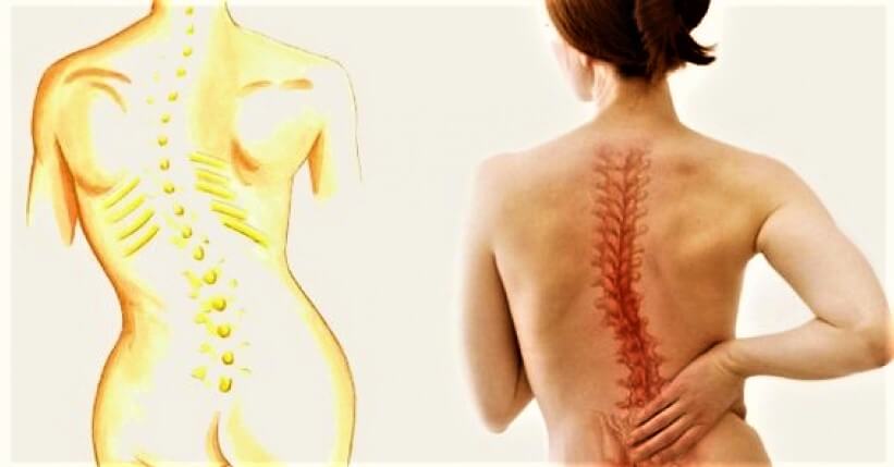 Kemik Erimesini (Osteoporoz) Nasıl Önleyebilirsiniz? kemik erimesi